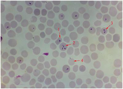 A Historical Overview of Research on Babesia orientalis, a Protozoan Parasite Infecting <mark class="highlighted">Water Buffalo</mark>